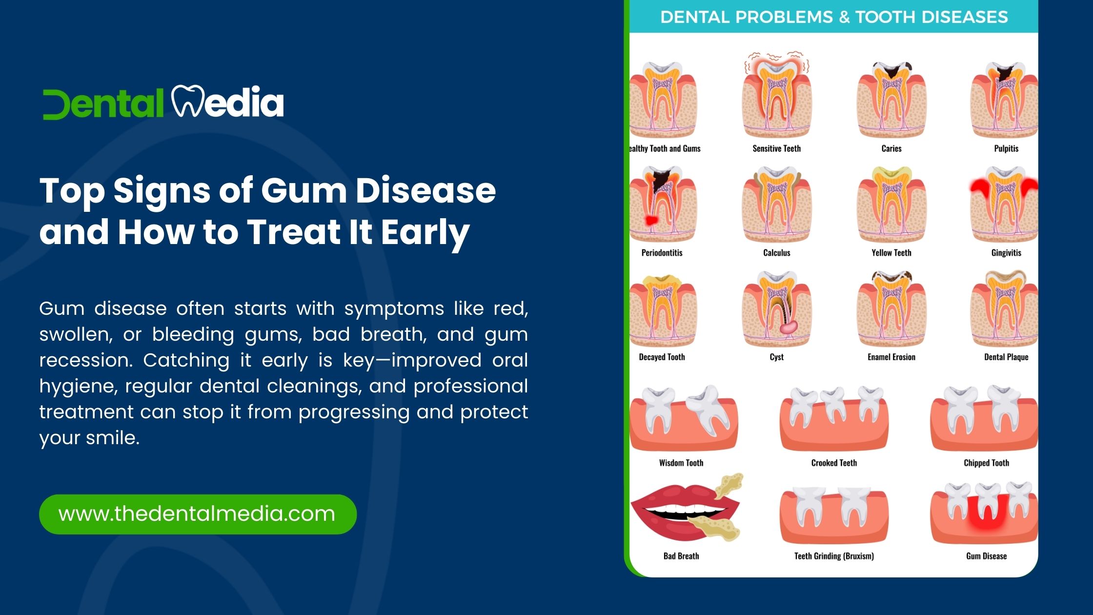 Top Signs of Gum Disease and How to Treat It Early