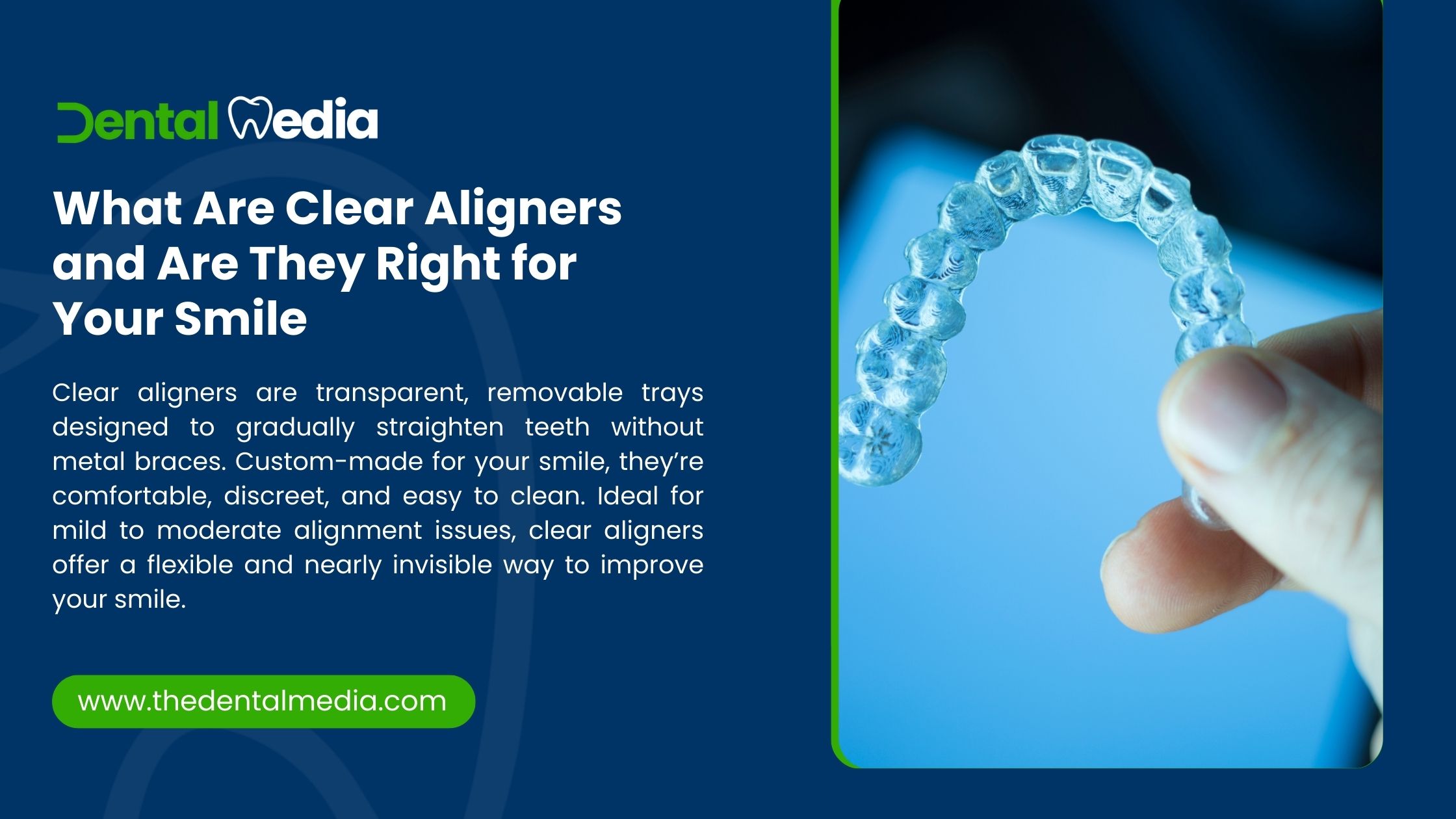 What Are Clear Aligners and Are They Right for Your Smile